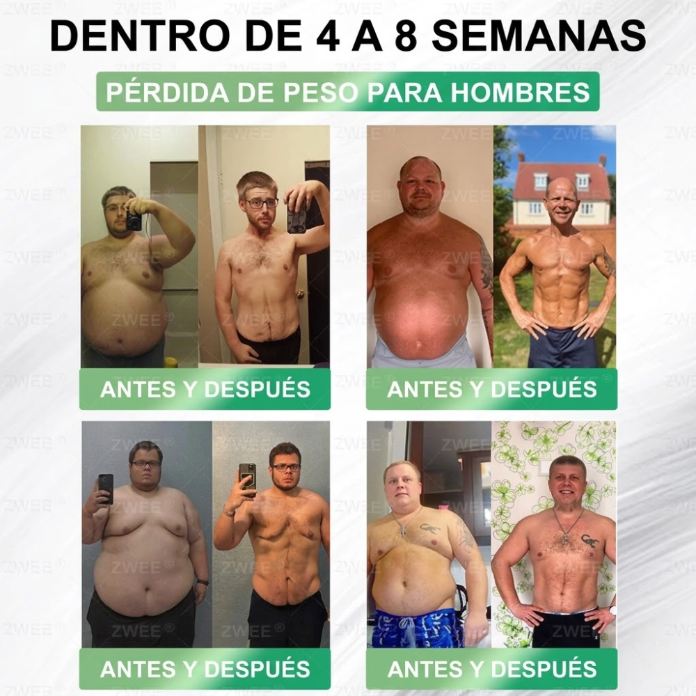 Official Store | ZWEEN® GLP-1 Oral 💊 12-in-1 Advanced Formula 🇲🇽 (Only 1 per day, visible changes in 7 days) 👨‍⚕️ Appetite control, metabolism, body fat, sleep apnea, joint problems and more 💝