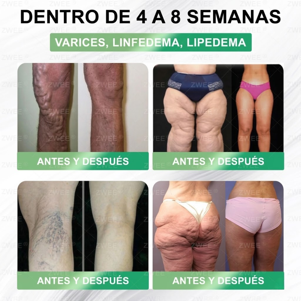 Official Store | ZWEEN® GLP-1 Oral 💊 12-in-1 Advanced Formula 🇲🇽 (Only 1 per day, visible changes in 7 days) 👨‍⚕️ Appetite control, metabolism, body fat, sleep apnea, joint problems and more 💝